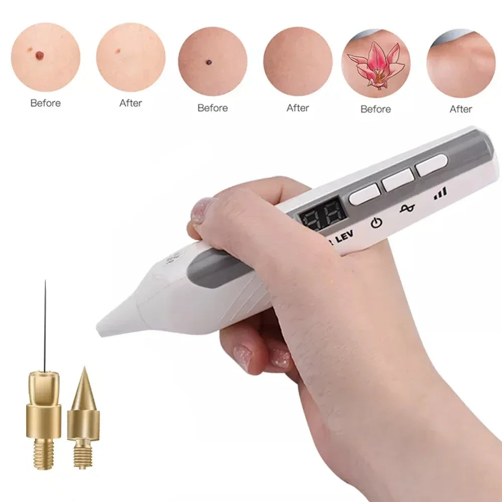 Medical Professional Fibroblast Plasma Pen USB