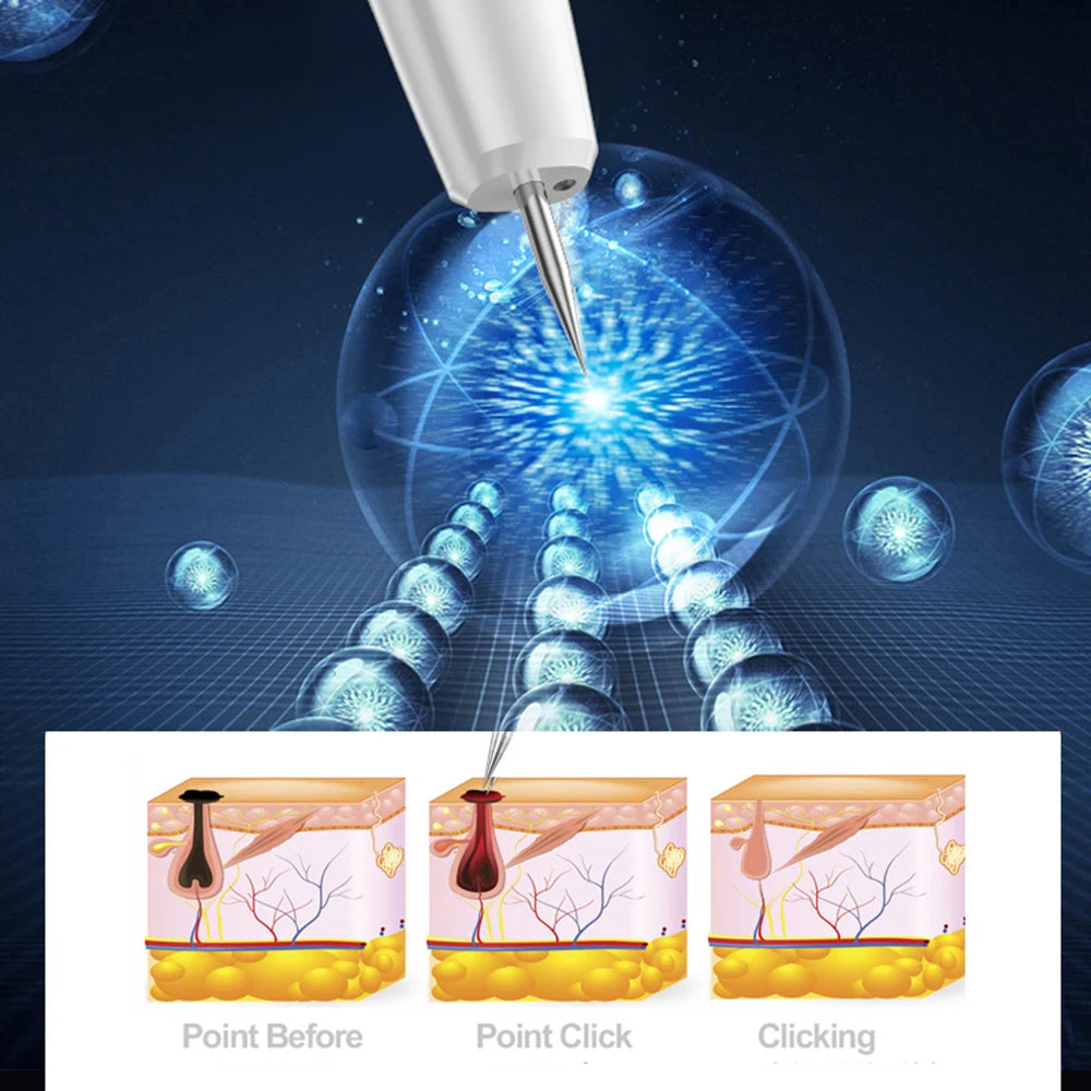 Plasma Pen Skin Tag Remover Freckle (15 Level)