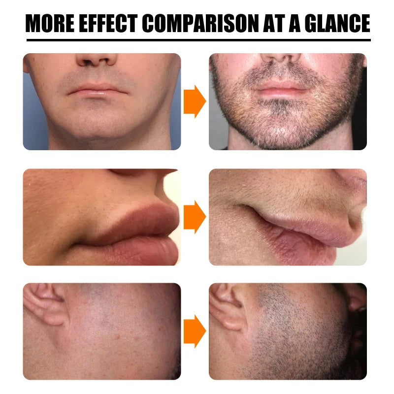 Beard Growth Essential Oil