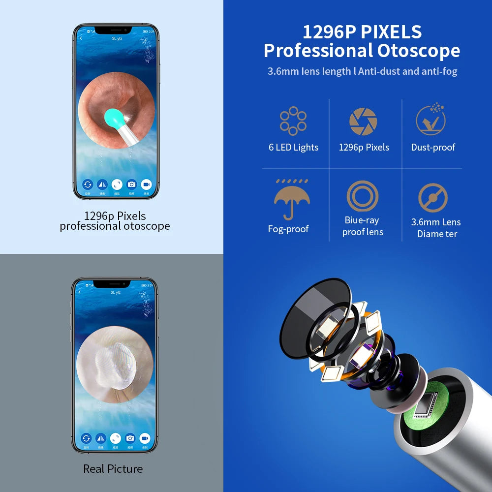 Health care product High Precision Ear Cleaner LED Professional Otoscope 6 LED Light Dust-proof, 3.6 mm lens diameter, fog-proof