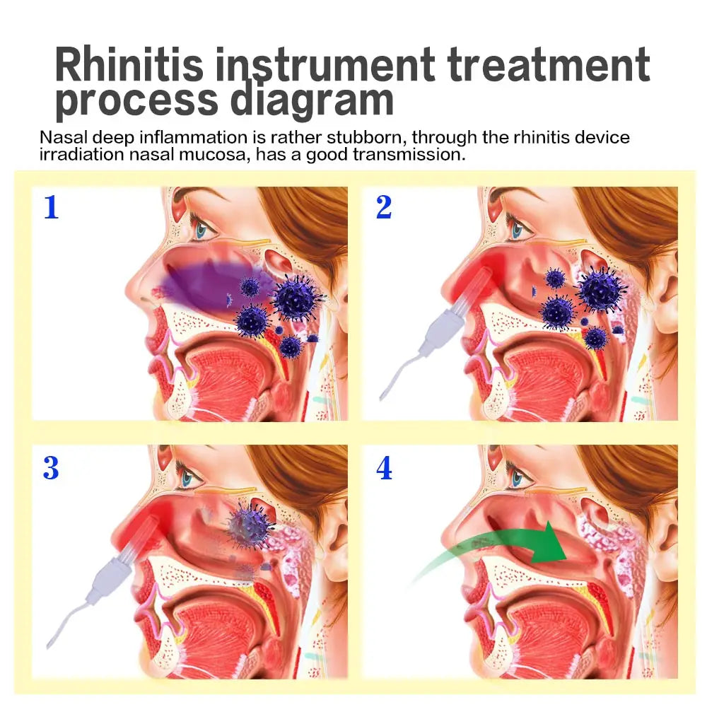 Health care products Nose therapy Massage Pulse Laser Rhinitis instrument treatment process diagram show in 4 steps