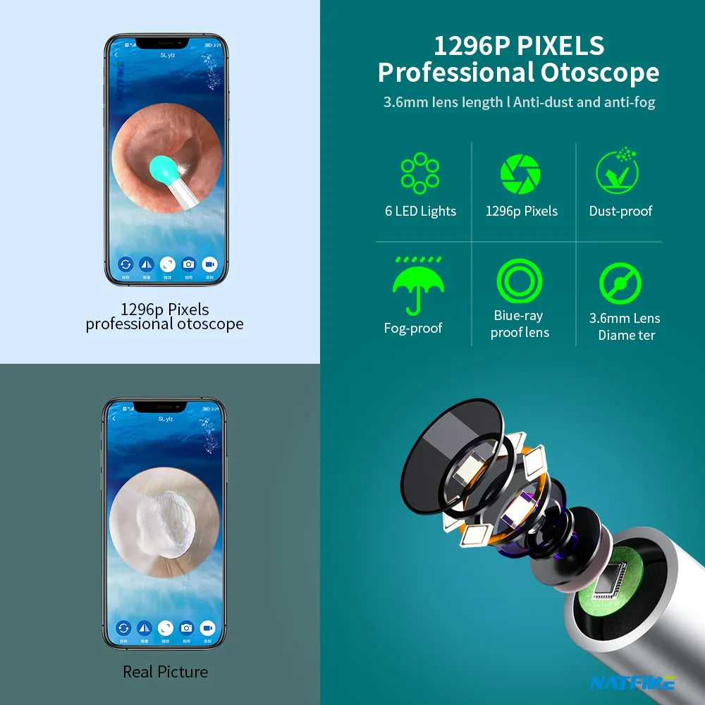 Health care products Otoscope Ear Cleaner Luminous Axis Smart Gyroscope Details 5 LED Lights 1296 Pixels, Dust-proof, anti-Fog, Blu-ray, 3.6 mm Lens diameter