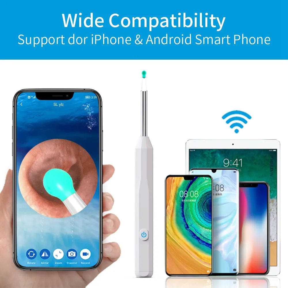 Health care products Otoscope Ear Cleaner Luminous Axis Smart Gyroscope Details Wide Compatibility, support dor iPhone & Android SmartPhone