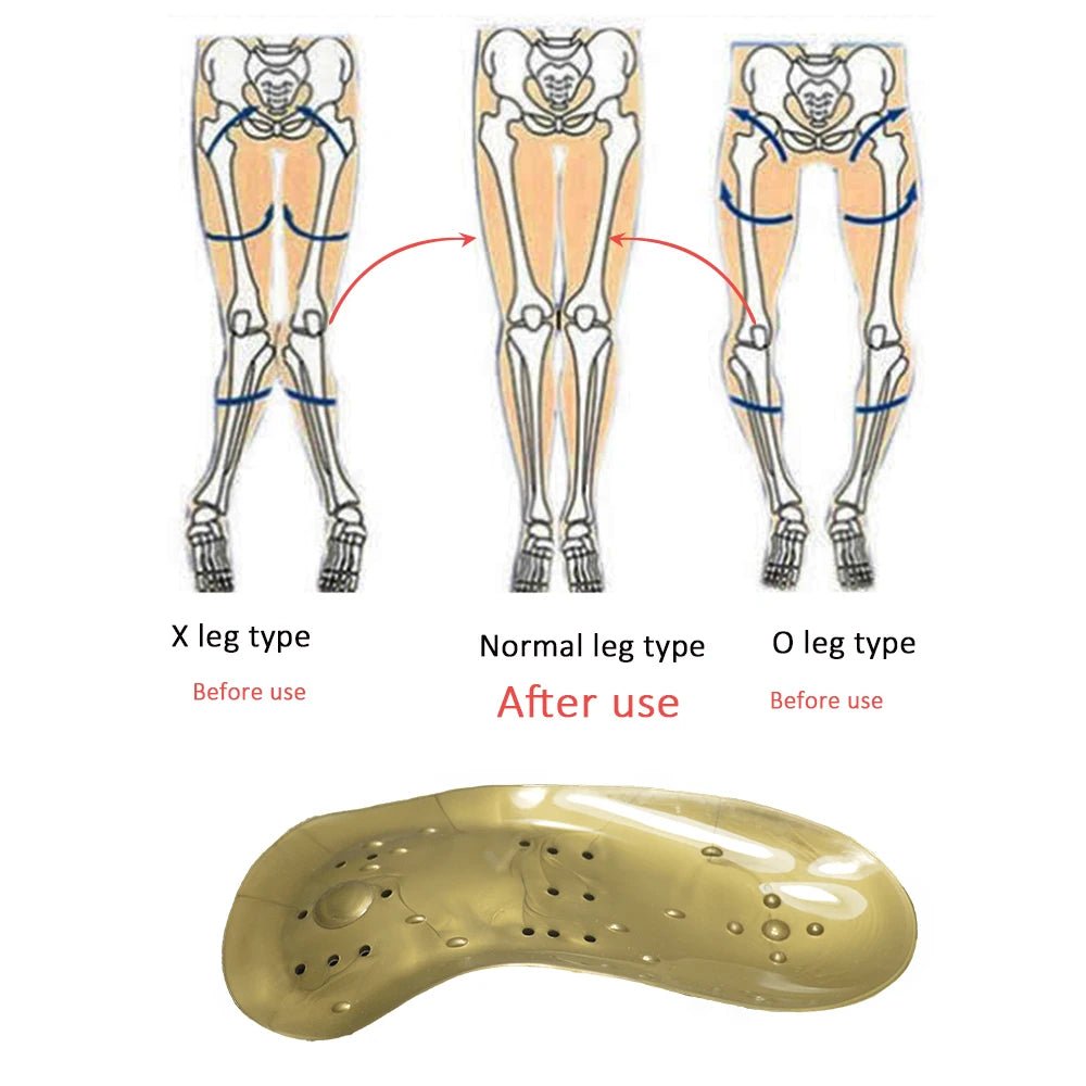 personal-health-care-after-use-correction-of-legs-alignment-show-picture