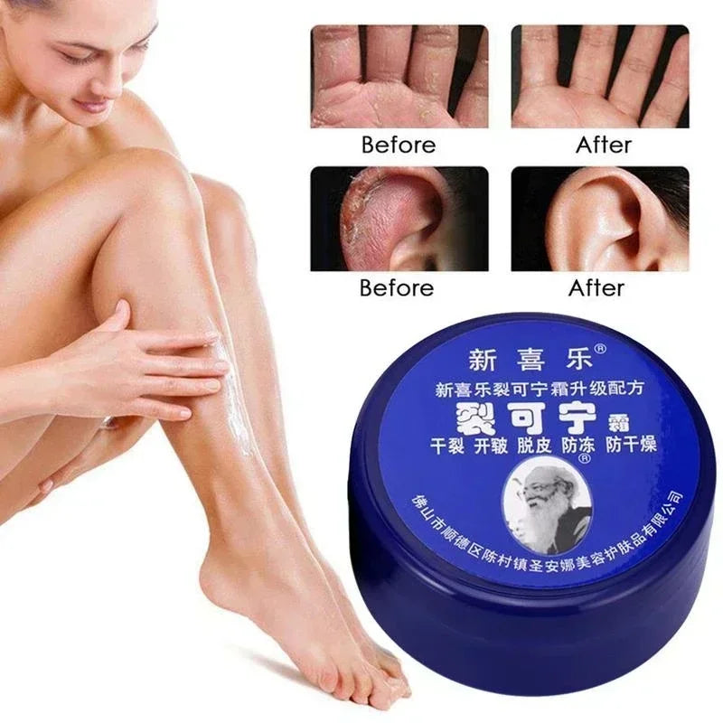 personal-health-care-anti-crack-cream-product-effects-on-hand-ear-woman-legs-before-and-after-use-picture