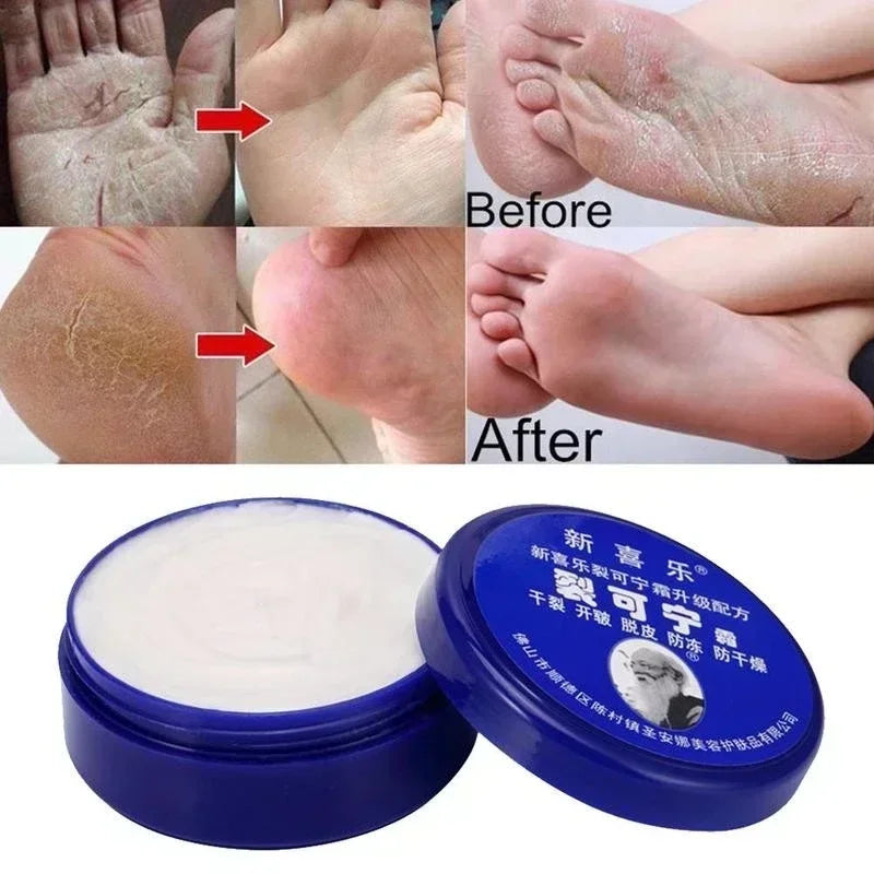 personal-health-care-anti-crack-cream-product-hand-foot-before-and-after-use-picture