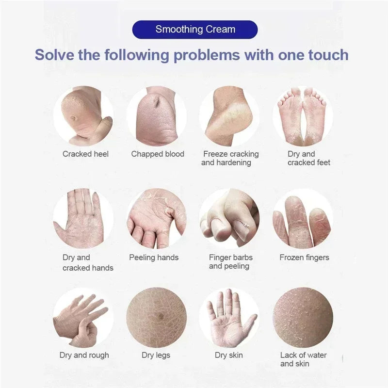 personal-health-care-anti-crack-cream-product-solve-the-following-problems-with-one-touch-picture