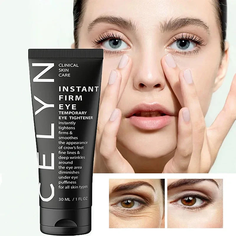 Personal health care eye cream wrinkle removal instant before and after use around eye treatment and women face regenerated picture