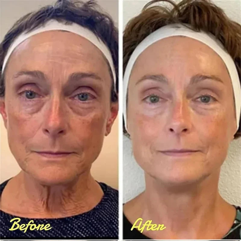 Personal health care eye cream wrinkle removal instant before and after use by a woman in her face
