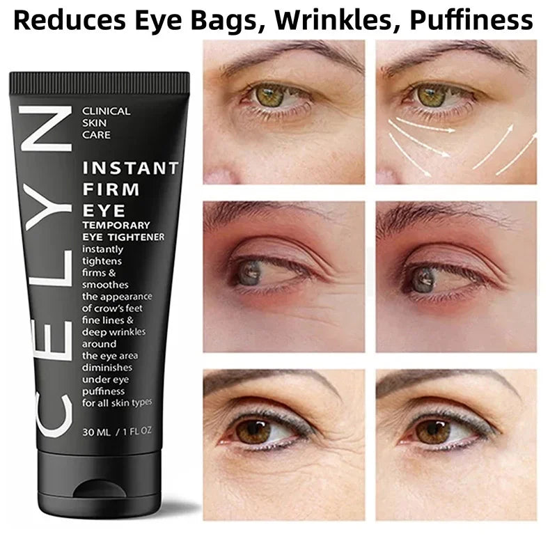 Personal health care eye cream wrinkle removal instant Personal health care eye cream wrinkle removal instant reduces eye bags wrinkles puffiness picture