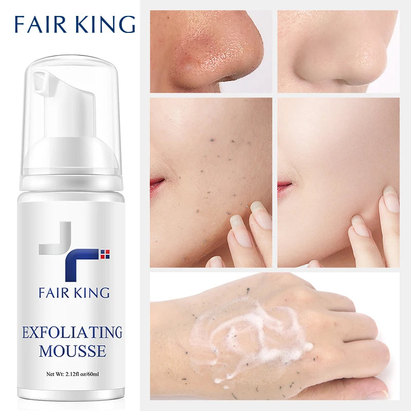 personal-health-care-facial-exfoliating-peeling-gel-cream-remove-nose-or-face-or-hand-dark-spots-picture
