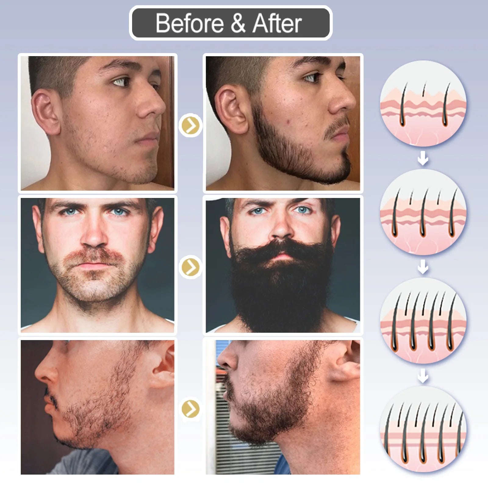 Personal Health care Men's Beard Growth Fluid before and after use on men's beard shown picture