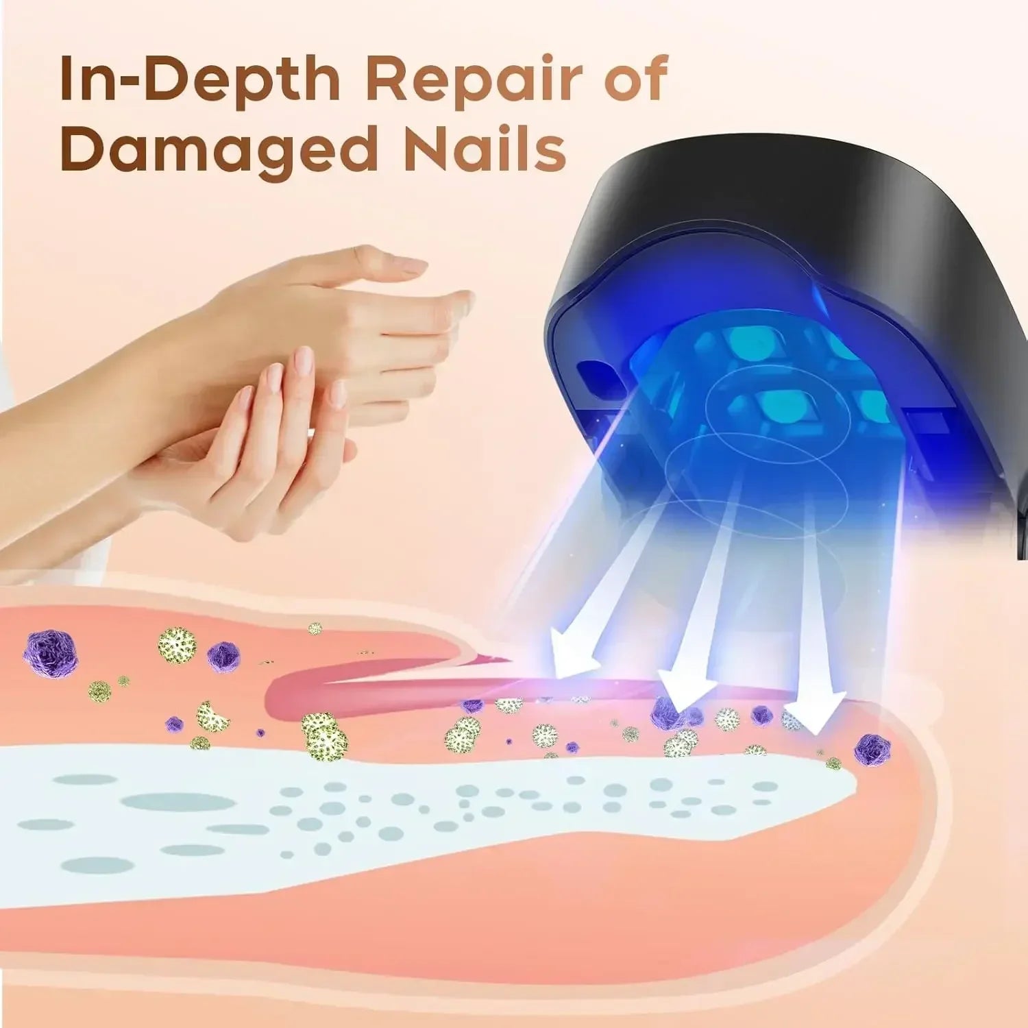 personal-health-care-nail-fungus-device-in-depth-repair-of-damaged-nail-show-picture