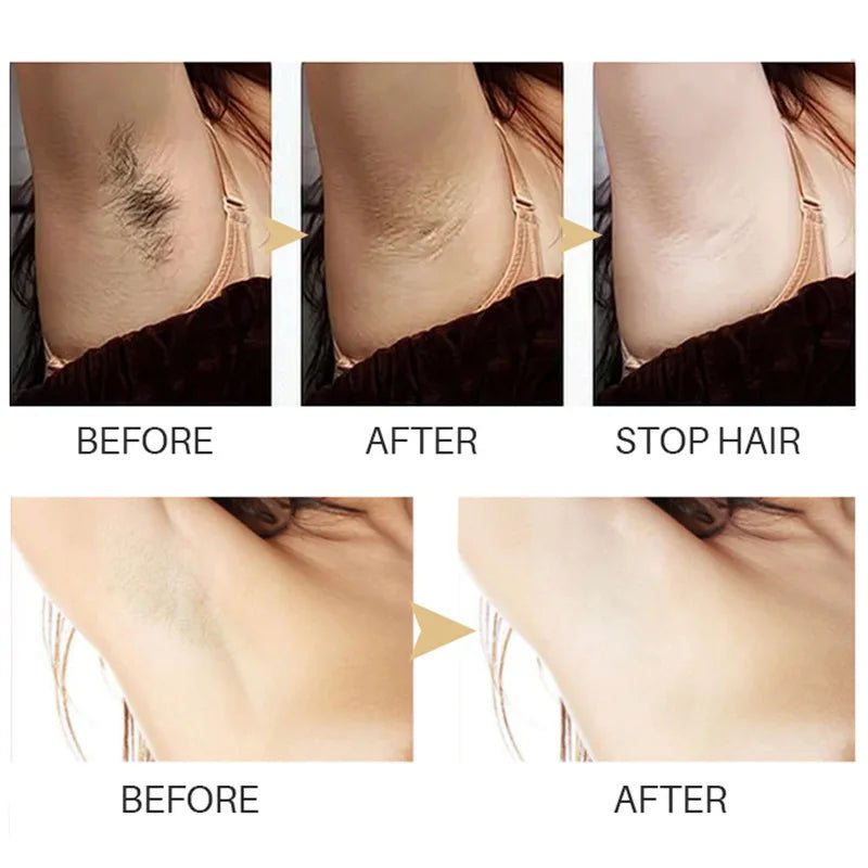 Personal Health care Permanent Hair Inhibition Woman Serum before and after use underarm picture