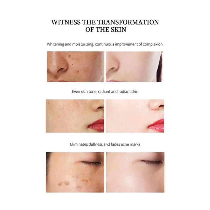 Personal Health Care Whitening Face and Remove Freckle Cream