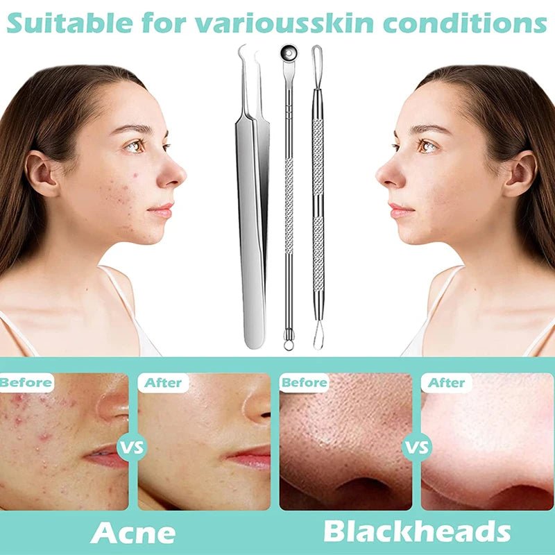 Acne Blackhead Remover Tools