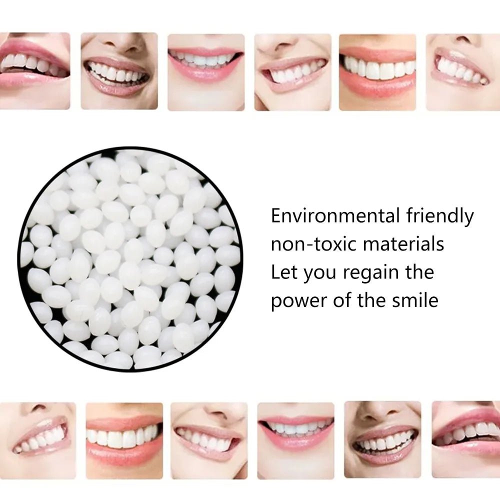 Temporary Tooth Repair Kit (15g/25g)