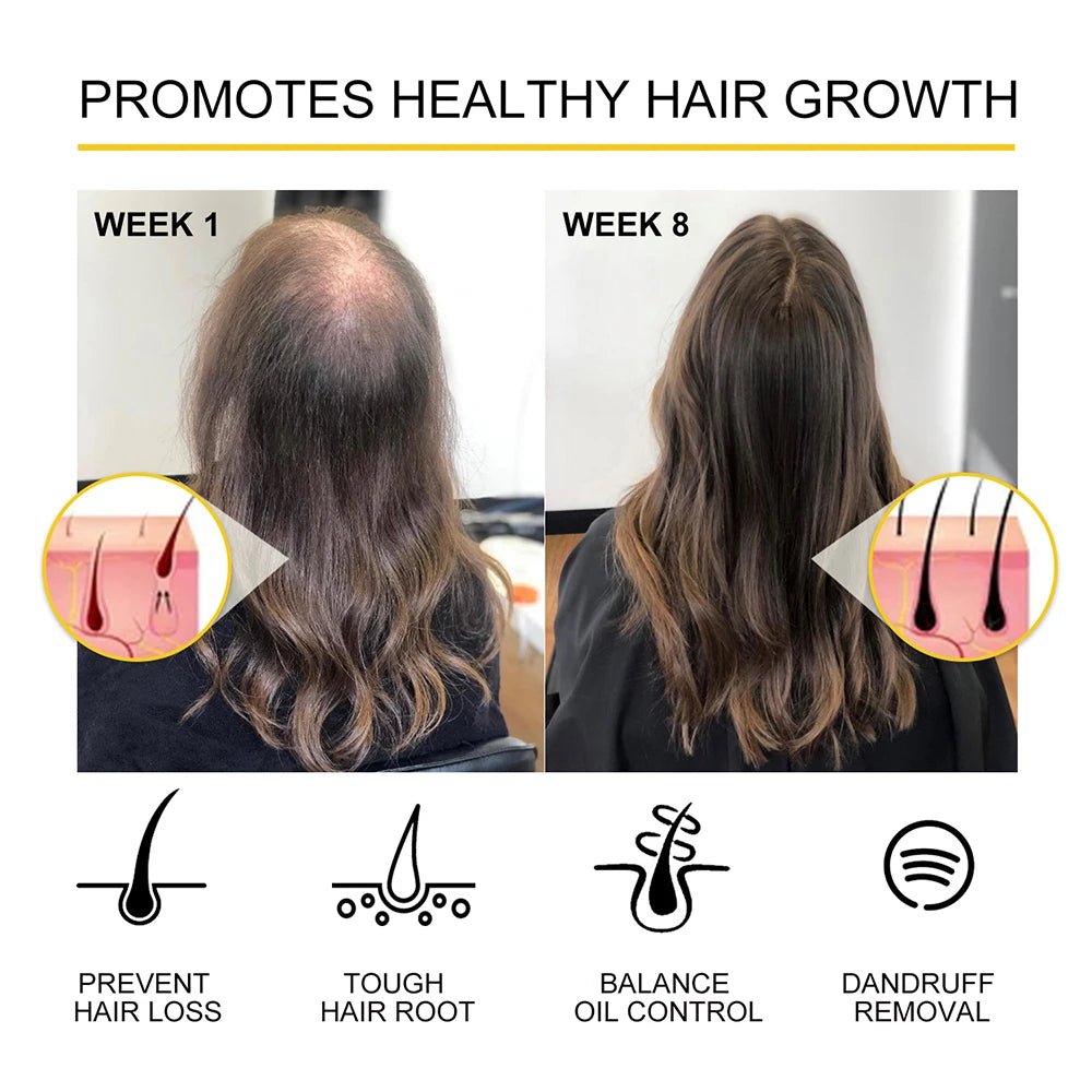 Health care products Hair Growth Massage Comb EMS RF Electric Promotes healthy hair grown after 1 week and 8 weeks use of all the products Very nice look