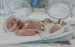 Free Picture of a premature baby- Blog: How to take care of a premature baby