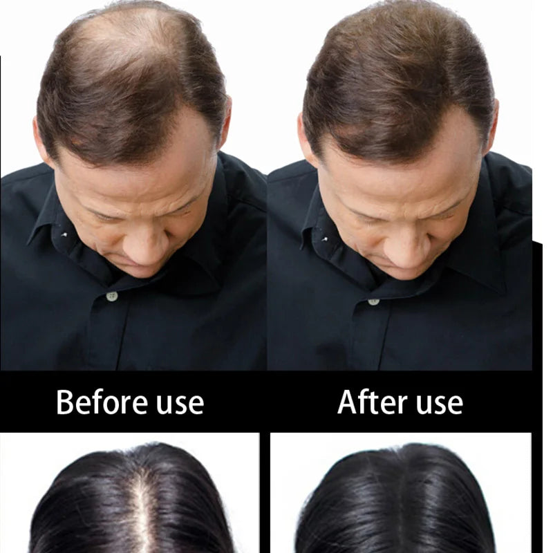 Keratin Hair Building Fibers Hair Loss Treatment