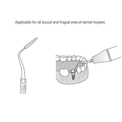 Dentistry Supplies Equipment AZDENT Periodontal Cleaning Tip PD90