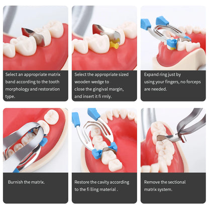 Matrix Sectional Contoured Clamps