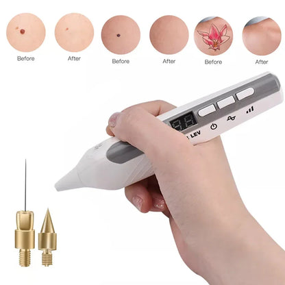 Professional Fibroblast Plasma Pen Electric