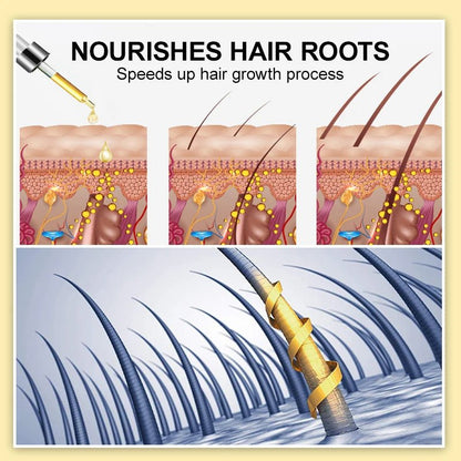 Personal Health Care Hair Oil Fast Thicken Unisex Ginger