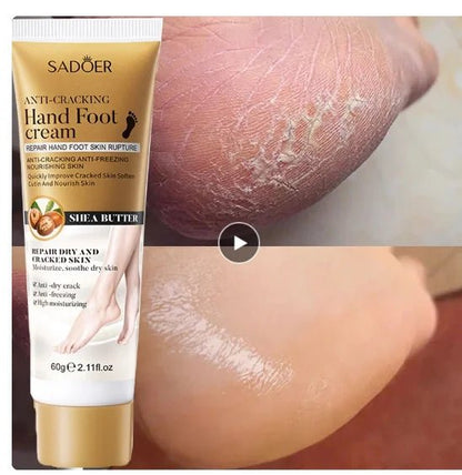 Personal Health Care Anti-Drying or Crack Hand Foot Cream