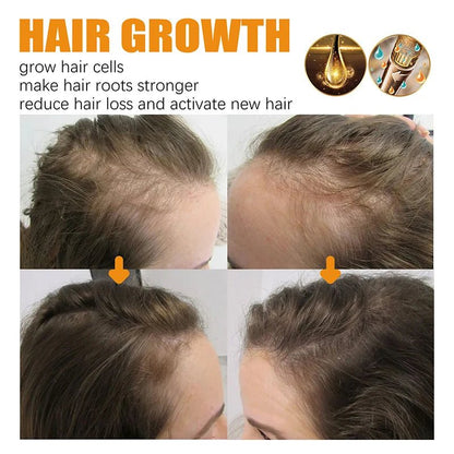 Personal Health Care Magical Hair Growth Spray: Fast, Safe Way to Longer, Stronger Hair!