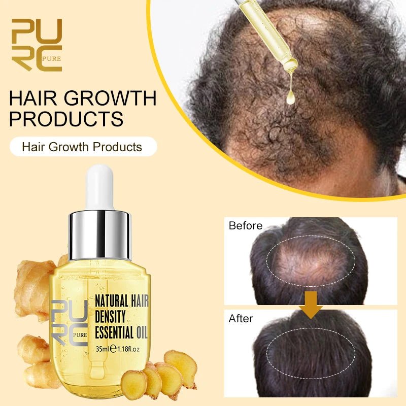Personal Health Care Hair Oil Fast Thicken Unisex Ginger