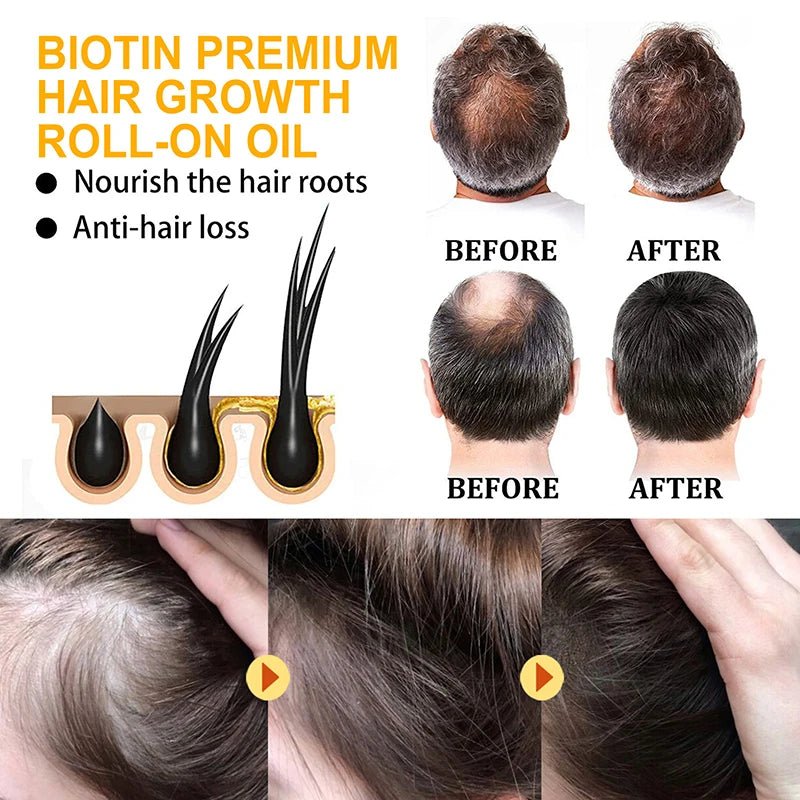 Personal Health Care Magical Hair Growth Spray: Fast, Safe Way to Longer, Stronger Hair!