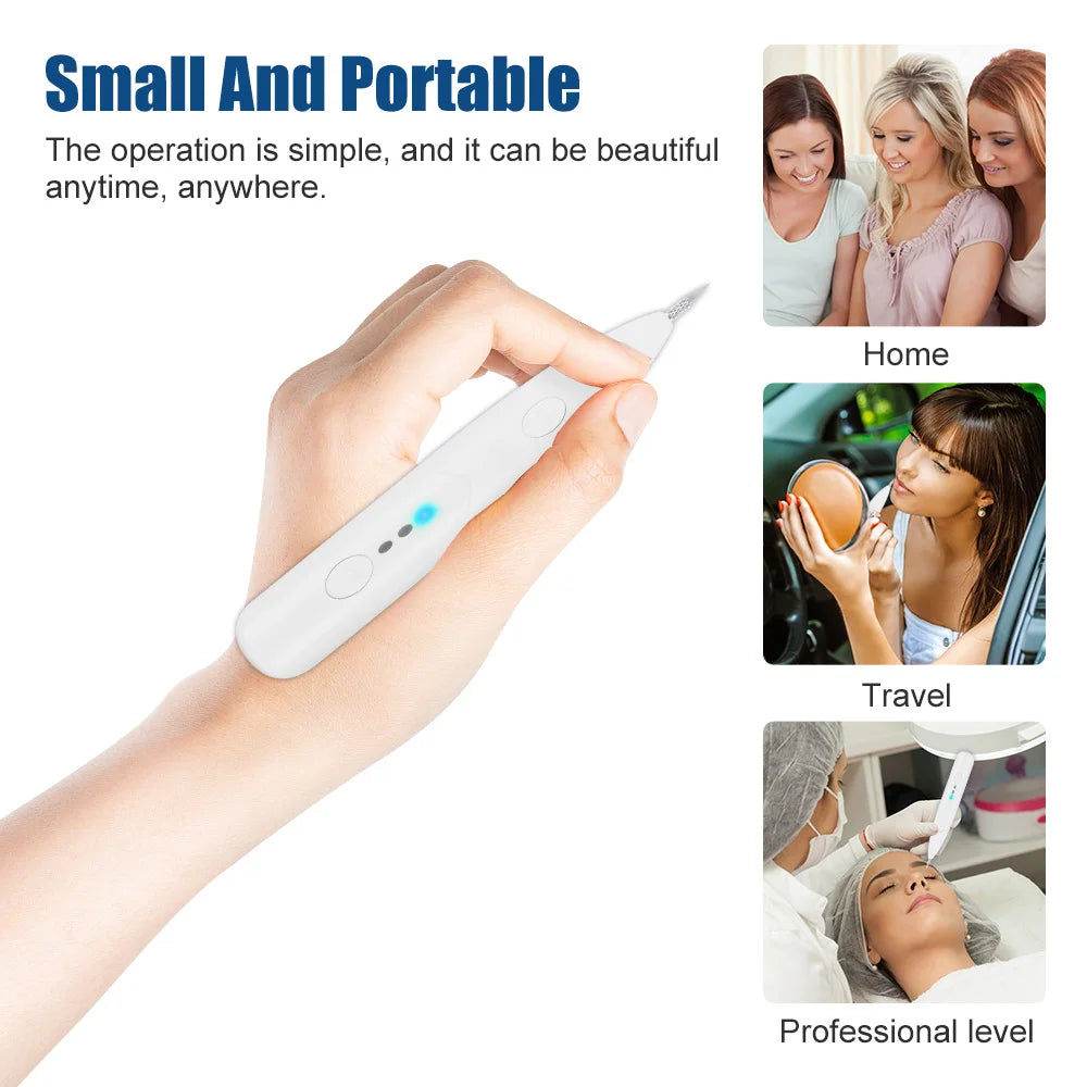 Plasma laser Jet Pen Tattoo + Freckles Removal