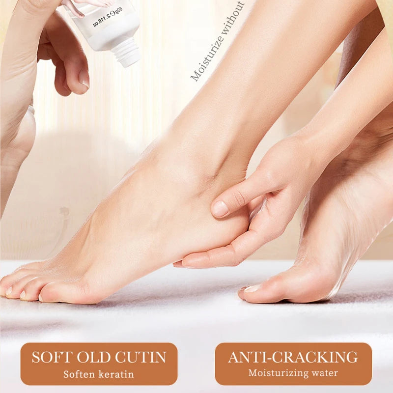 Anti-Drying or Crack Hand Foot Cream