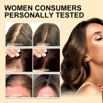 Personal Health Care Hair Oil Fast Thicken Unisex Ginger