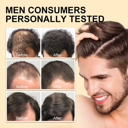 Personal Health Care Hair Oil Fast Thicken Unisex Ginger