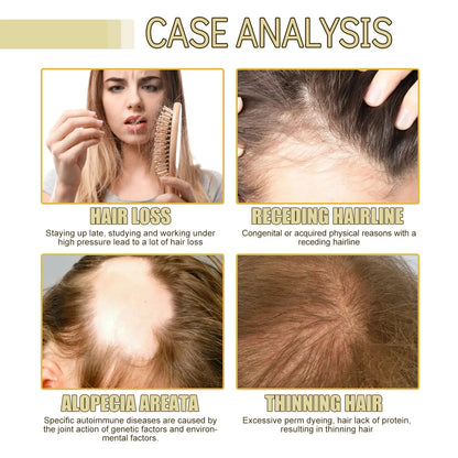 Personal Health Care Fast Hair Growth Oil Treatment Unisex
