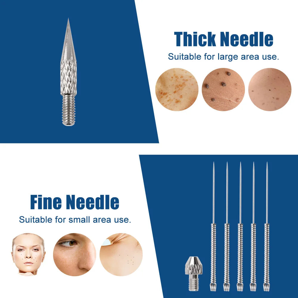 Plasma laser Jet Pen Tattoo + Freckles Removal