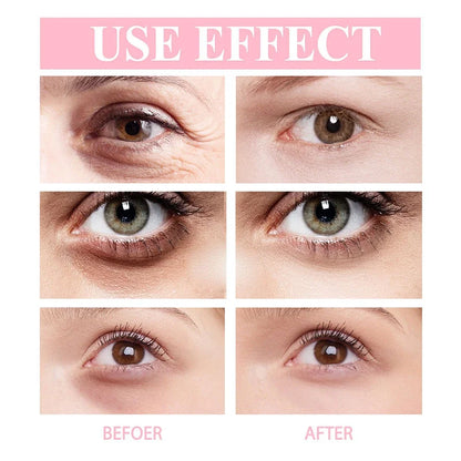 Anti-Wrinkle Eye Cream, Wrinkle Removing