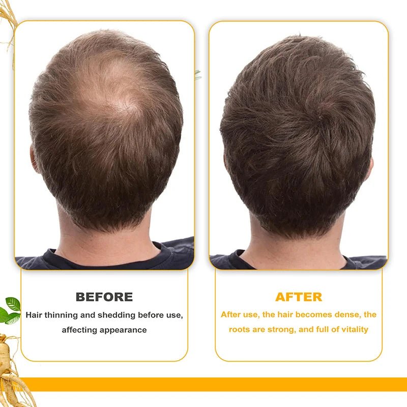 Personal Health Care Magical Hair Growth Spray: Fast, Safe Way to Longer, Stronger Hair!