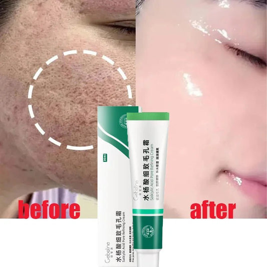 Personal Health Care Salicylic Acid Shrink Pore Cream