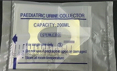 Baby Health Care, Picture of a urinary bag sample, Blog: Paediatric urine test (for hereditary transmitted diseases).