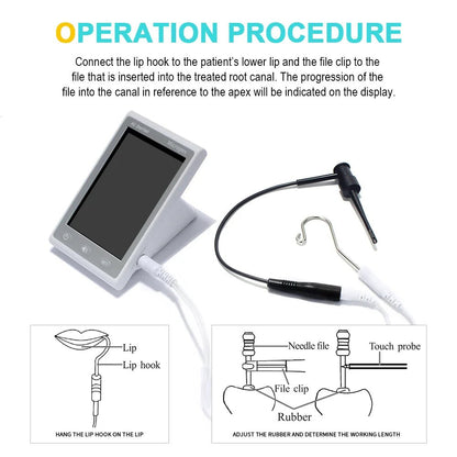 Dentistry Supplies & Equipment Endodontic Root Canal Micro Locator
Picture of the Operation Procedure