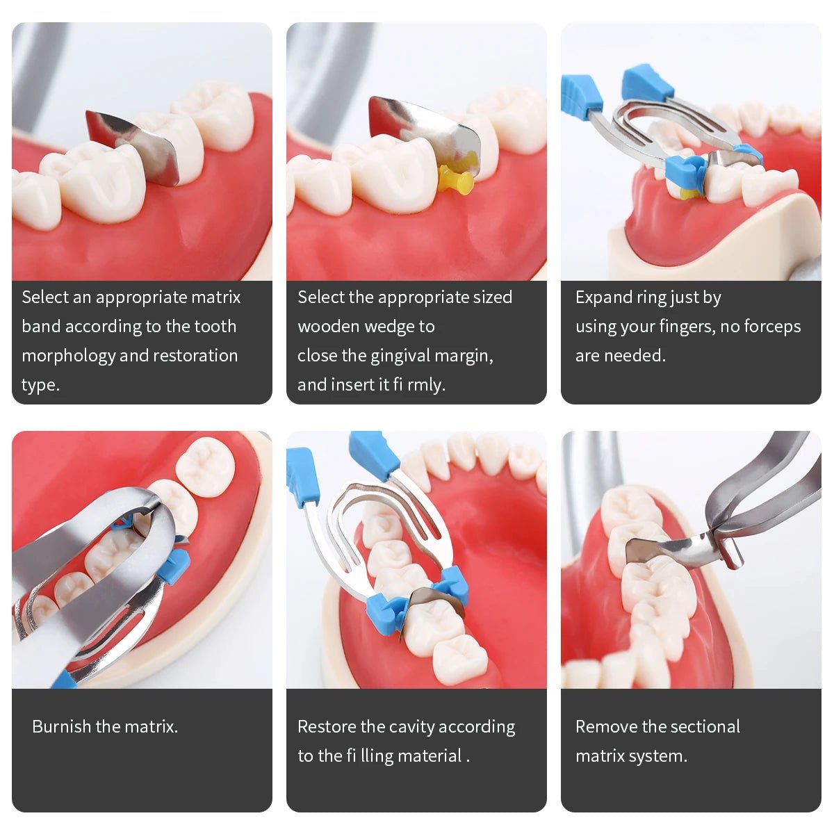 Dentistry Supplies & Equipment Matrix Sectional Contoured Clamps All 6 usage mode of a clamp shown