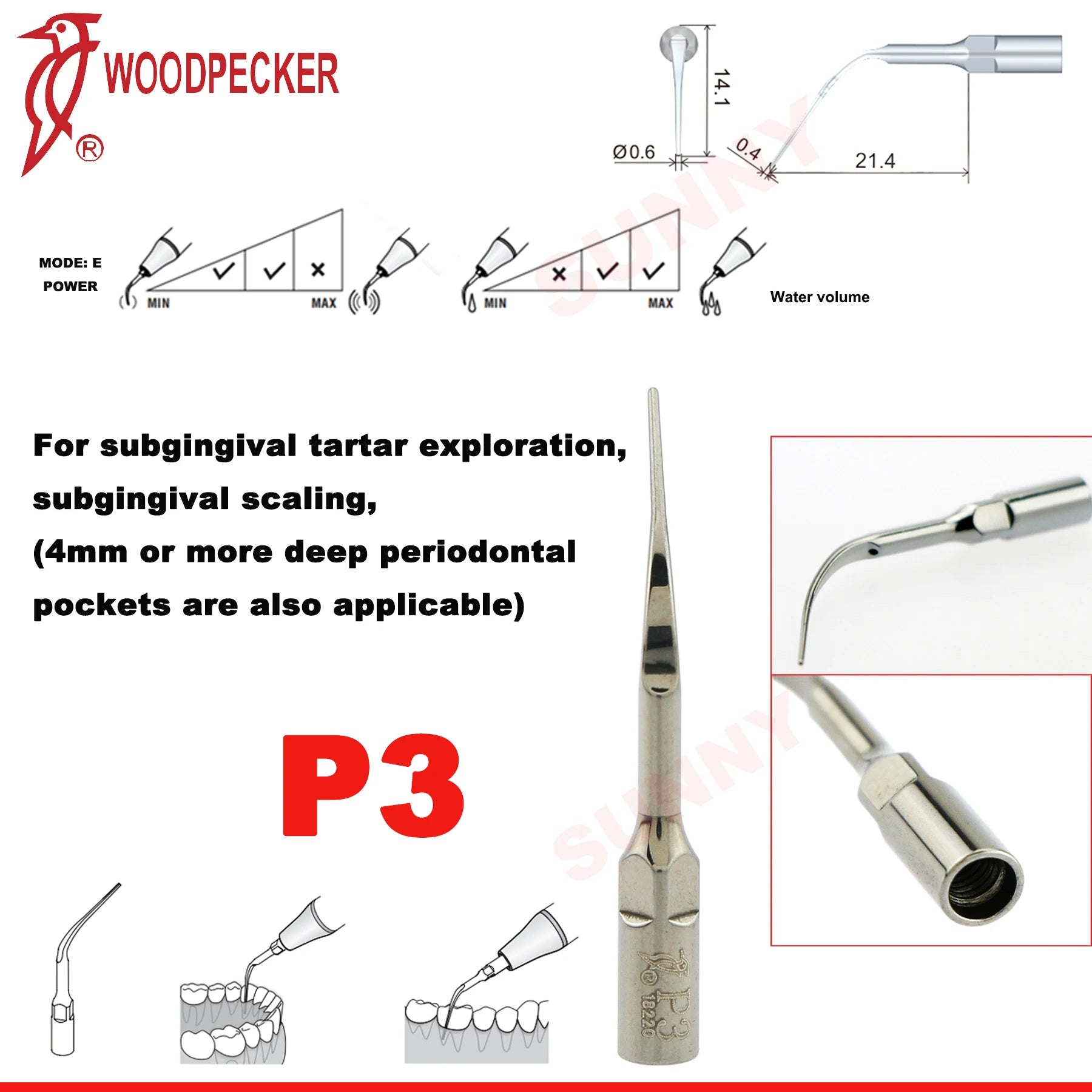Dentistry Supplies & Equipment Scaler Tips Ultrasonic Tooth Cleaning
(Picture of P3 Piece Offers + sizes and Detail)