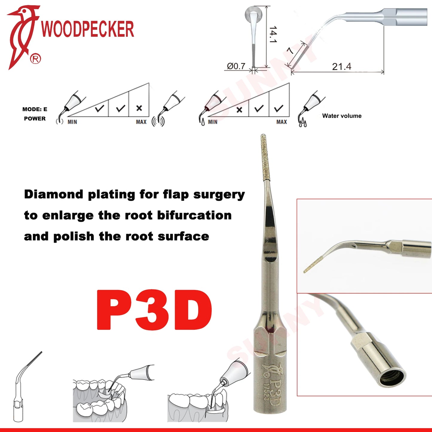 Dentistry Supplies & Equipment Scaler Tips Ultrasonic Tooth Cleaning
(Picture of P3D Piece Offers + sizes and Detail)