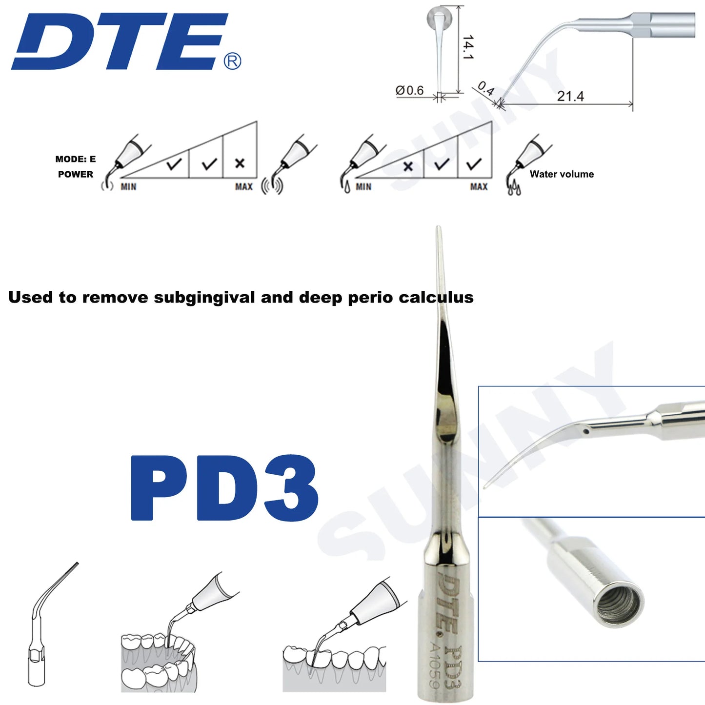 Dentistry Supplies & Equipment Ultrasonic Tooth Cleaning -  (Woodpecker DTE Set PD3 Piece Offers with sizes and details shown on the picture)