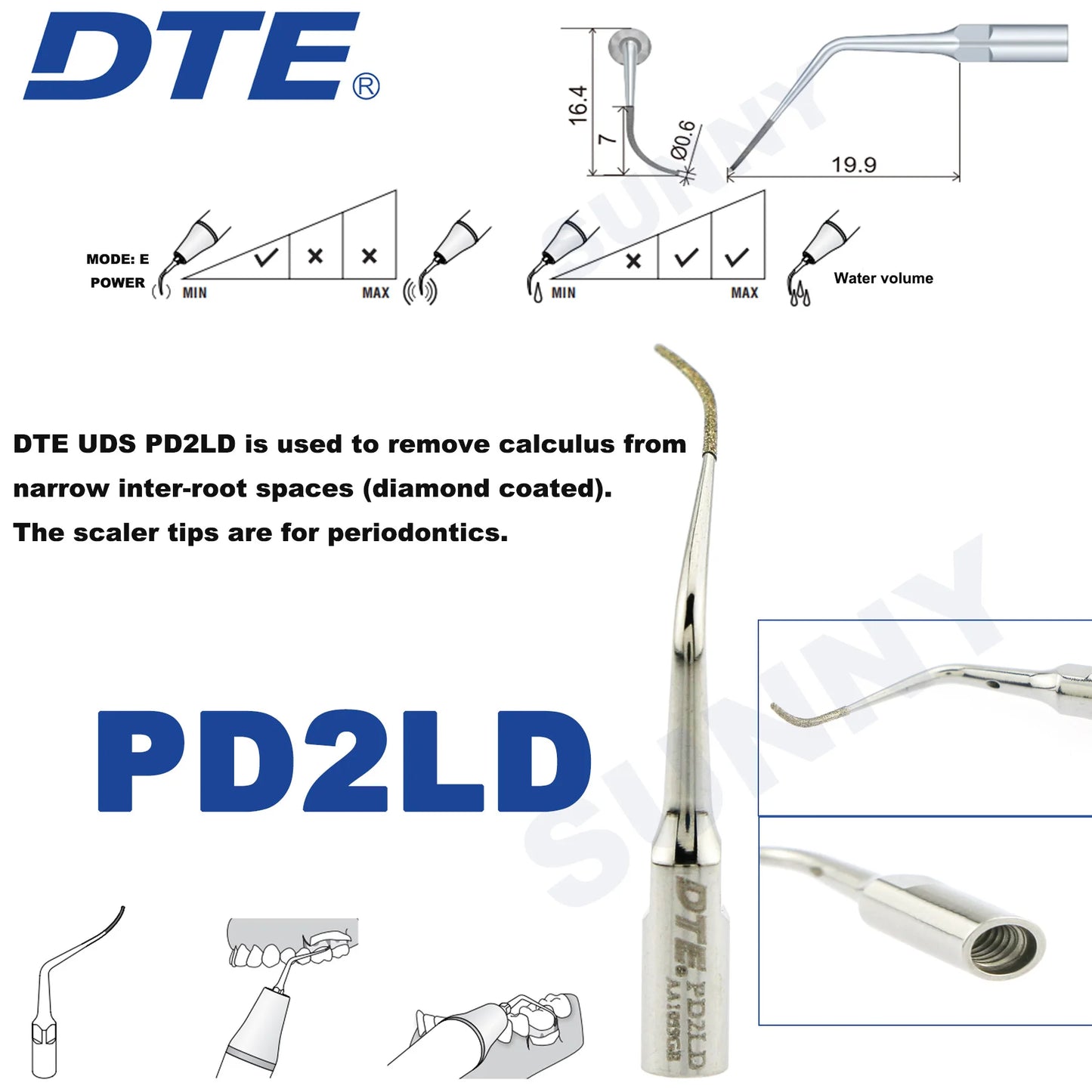 Dentistry Supplies & Equipment Ultrasonic Tooth Cleaning -  (Woodpecker DTE Set PD2LD Piece Offers with sizes and details shown on the picture)