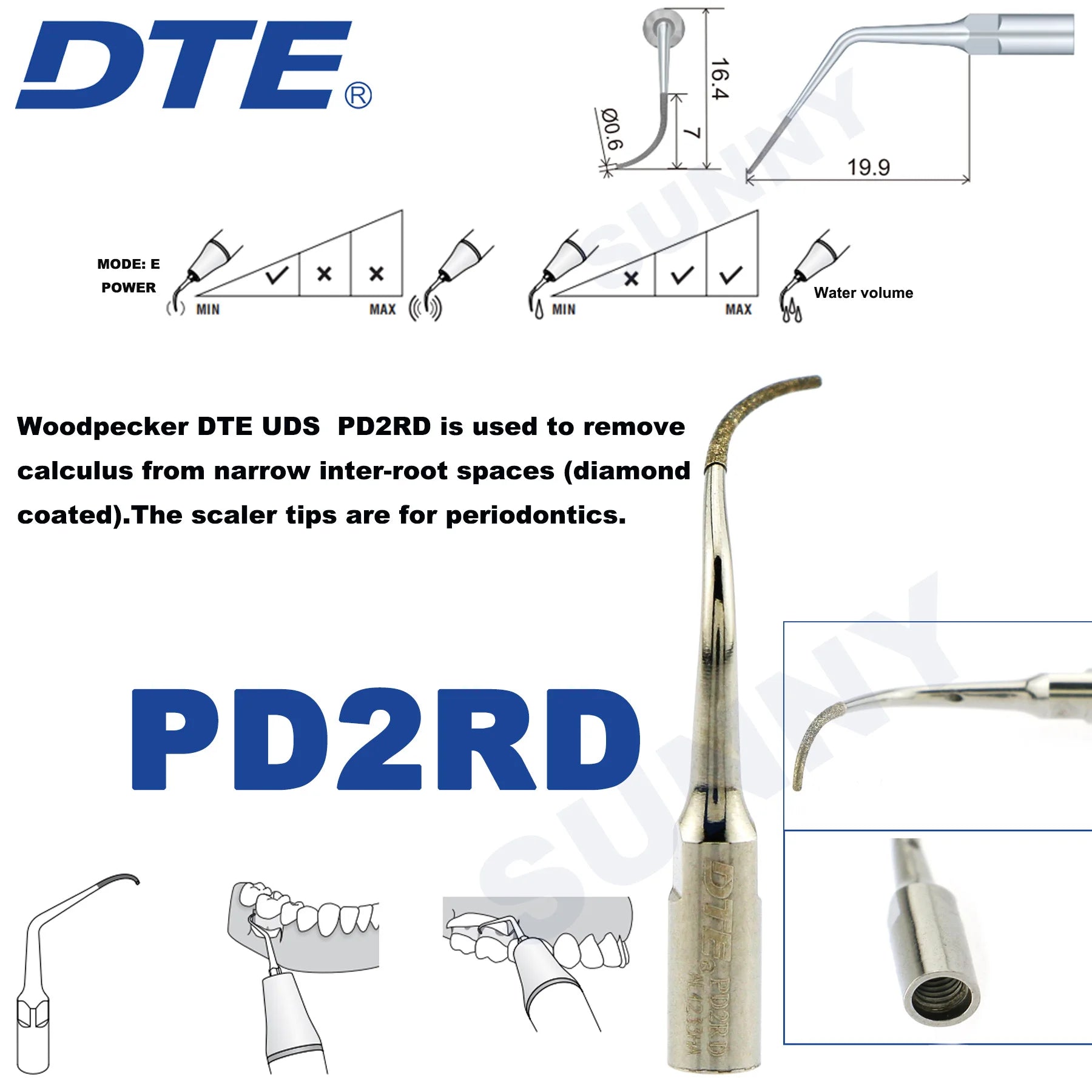Dentistry Supplies & Equipment Ultrasonic Tooth Cleaning -  (Woodpecker DTE Set PD2RD Piece Offers with sizes and details shown on the picture)