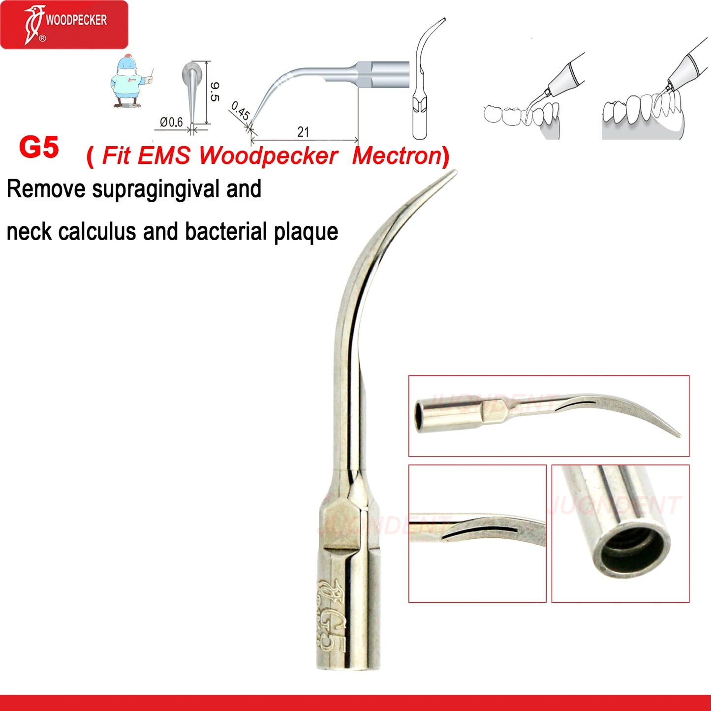 Dentistry Supplies & Equipment Woodpecker Dental Ultrasonic Scaler Build In UDS N2/N3 Scaler Tips (Picture of Scaler Tip Set G5 (Fit EMS Woodpecker Mectron) Offers + details +sizes)